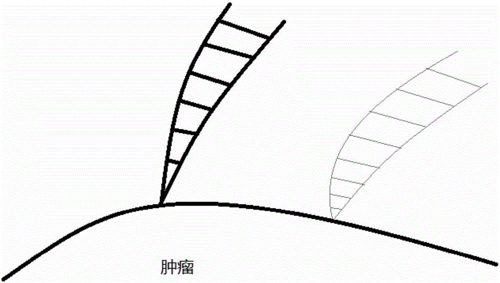 一种基于微分流行的多b值DWI图像评估的方法与流程