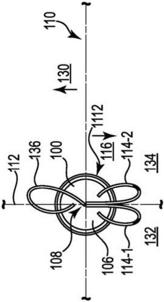 用于電神經(jīng)調(diào)制的導(dǎo)管和導(dǎo)管系統(tǒng)的制作方法與工藝