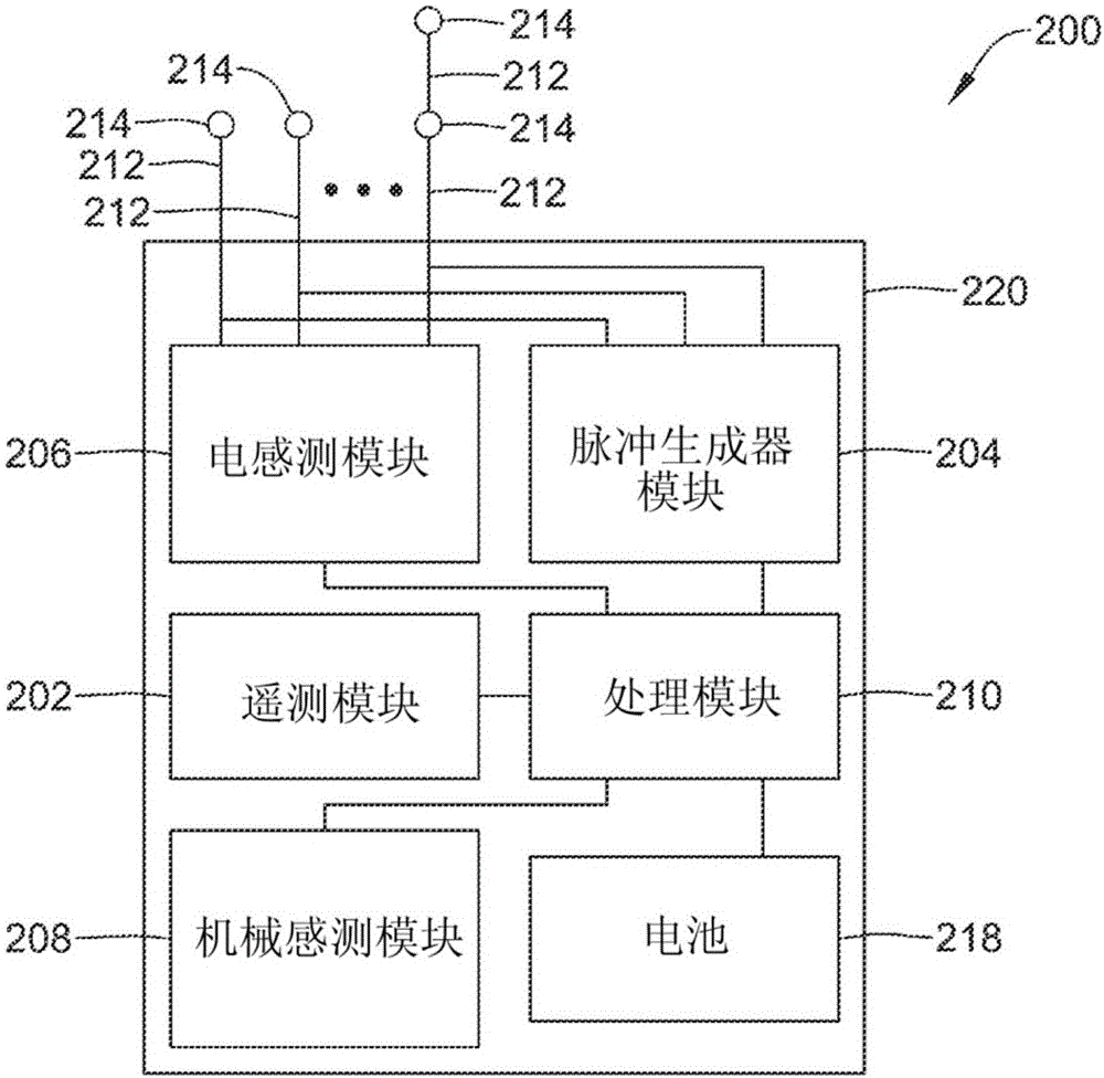 用于治疗心律不齐的系统和方法与流程