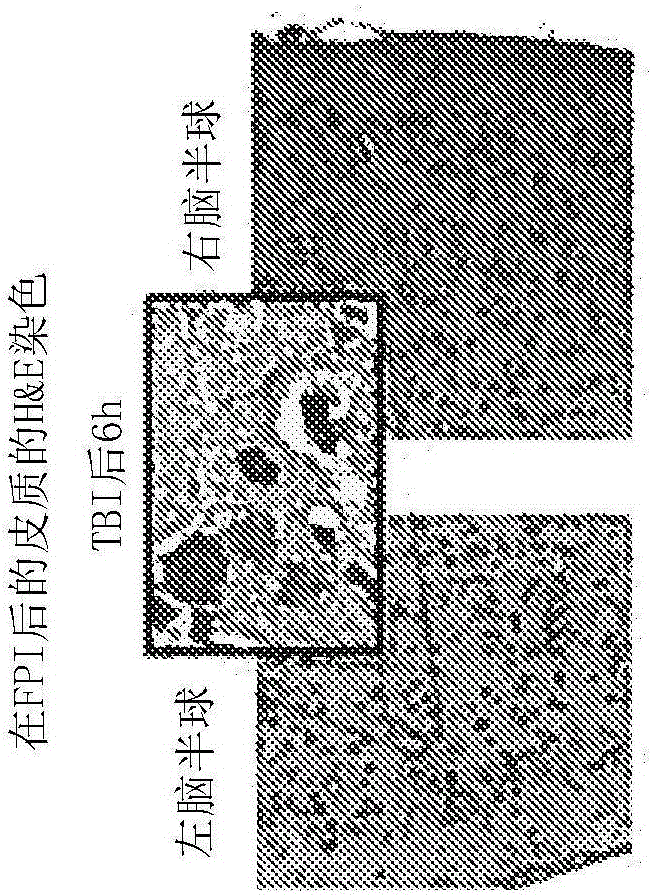 FLAP抑制剂的降低中枢神经系统内的神经炎症介导的损伤的应用的制作方法与工艺