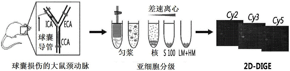 用于診斷血管疾病的生物標(biāo)志物及其用途的制作方法與工藝