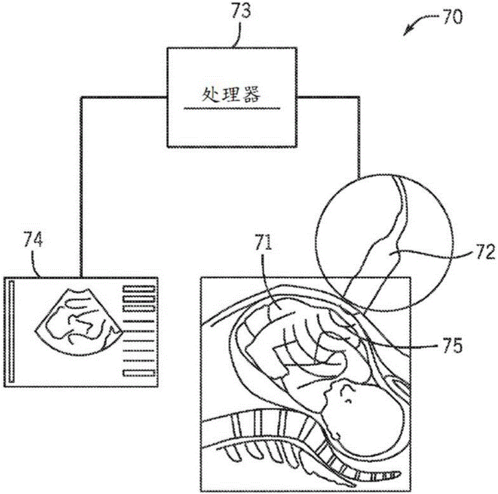 波場(chǎng)重建的制作方法與工藝