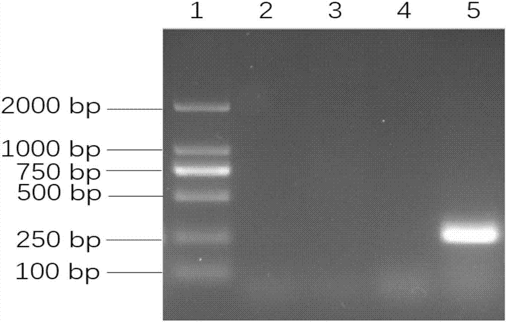 一种基于荧光定量PCR鉴定啮齿类螺杆菌的引物、试剂盒及鉴定方法与流程