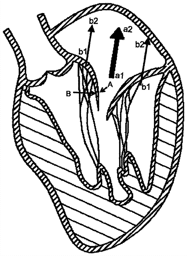 一种带夹持装置的心脏瓣膜假体的制造方法