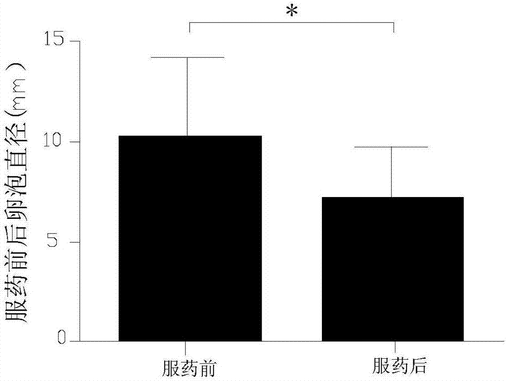 用于多囊卵巢综合症的滋肾散结消囊中药组合物及其应用的制造方法与工艺