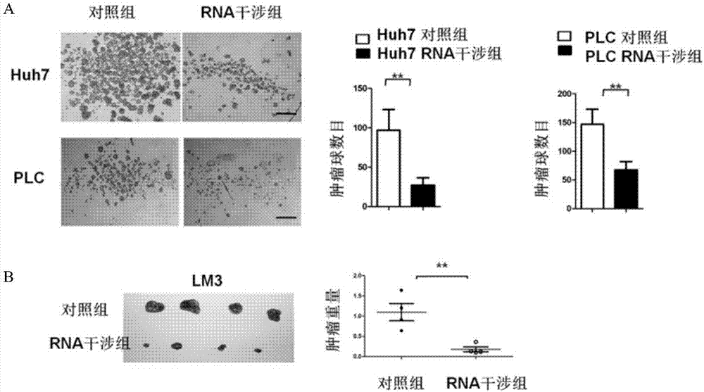 一种用于肝癌与肝癌微环境相互作用的新的长链非编码RNA检测及其应用的制造方法与工艺