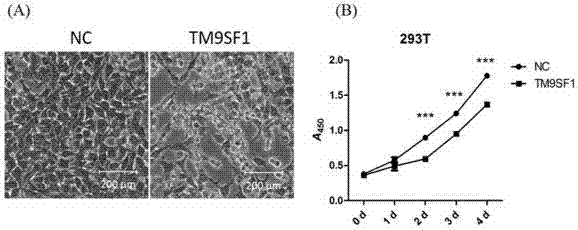 TM9SF1蛋白的应用和重组TM9SF1慢病毒表达载体及其构建方法与流程
