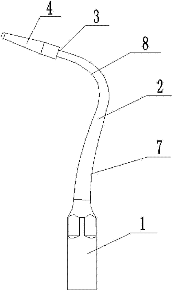 一種帶塑料頭的牙周治療工作頭的制造方法與工藝