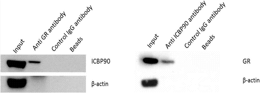 ICBP90抗體及其表達抑制劑在制備促進糖皮質(zhì)激素治療效果的藥物中的應(yīng)用的制造方法與工藝