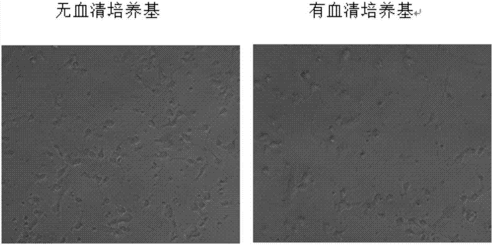 一種神經(jīng)細(xì)胞無(wú)血清培養(yǎng)基及其應(yīng)用的制造方法與工藝