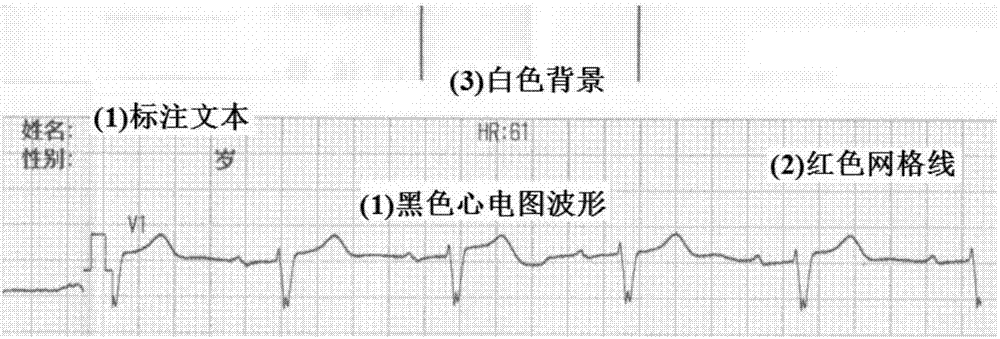 一种心电图扫描图像倾斜度校正方法与流程