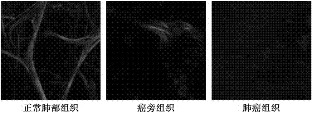 一种基于肺部自荧光的减少作为检测肺癌组织的标志的检测方法及其应用与流程