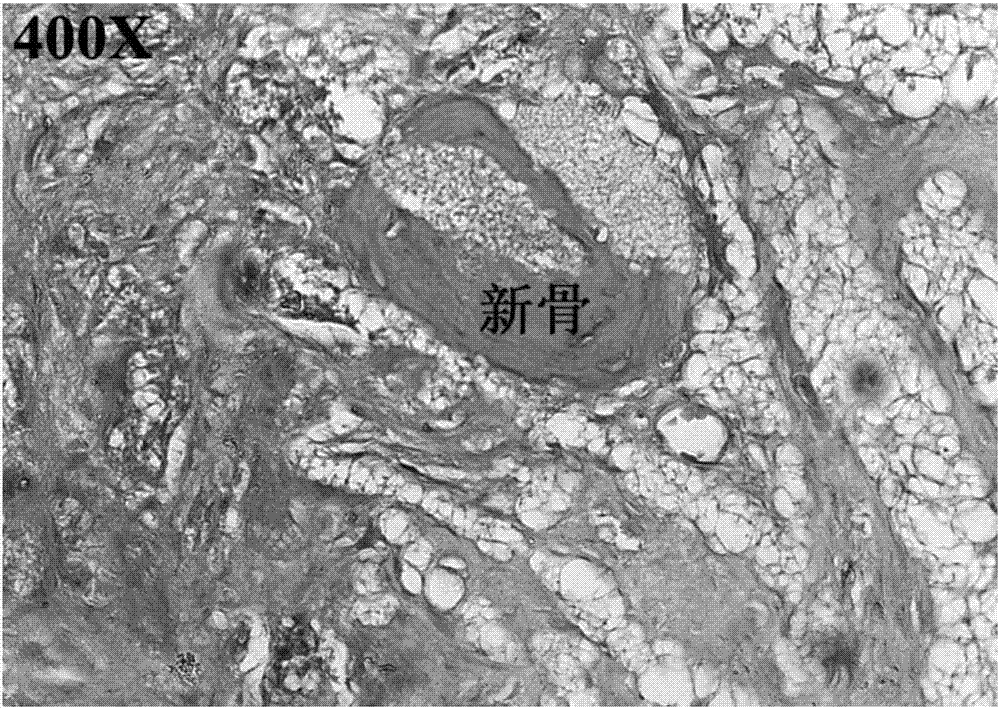 用于骨修復(fù)的纖維基三維多孔復(fù)合材料及其制備方法以及成型品與流程