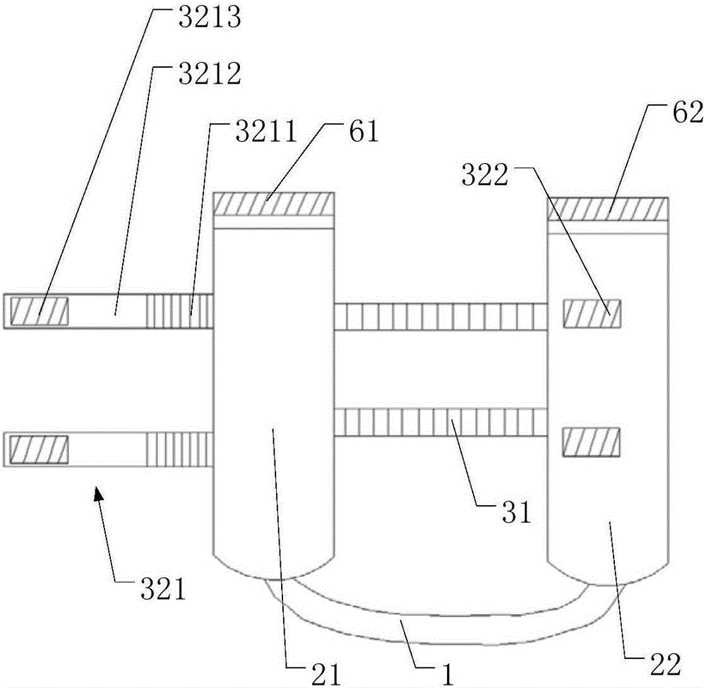 脚踝护具及其系统的制造方法与工艺