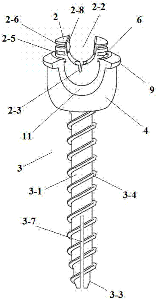 一种提拉锁紧型万向椎弓根螺钉的制造方法与工艺