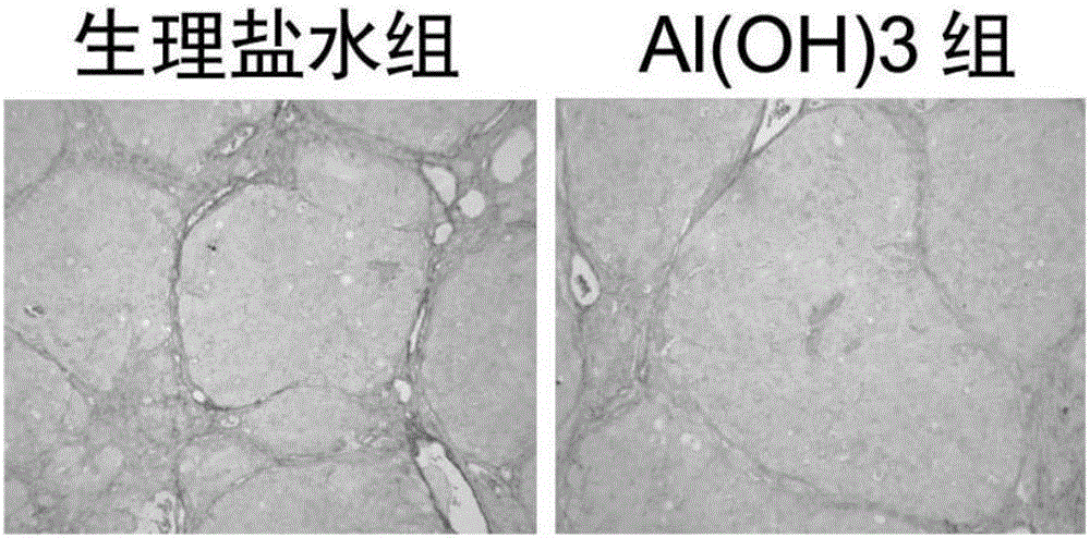 氫氧化鋁在制備防治肝纖維化藥物中的應用的制造方法與工藝