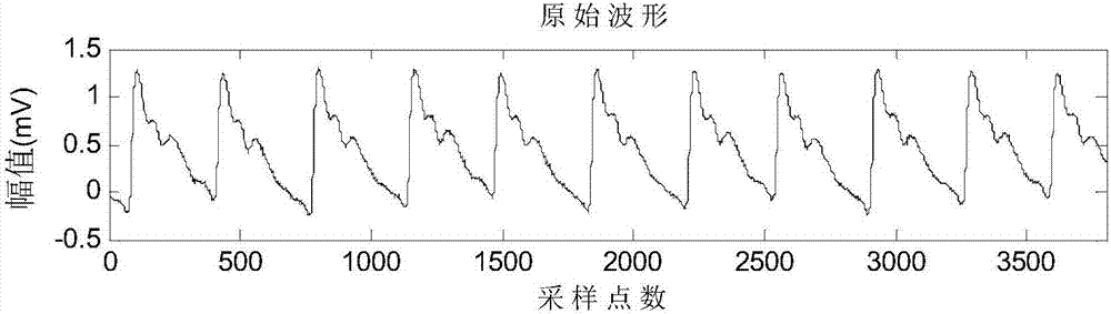 基于dtcwt62spline的脉搏波信号去噪处理方法与流程