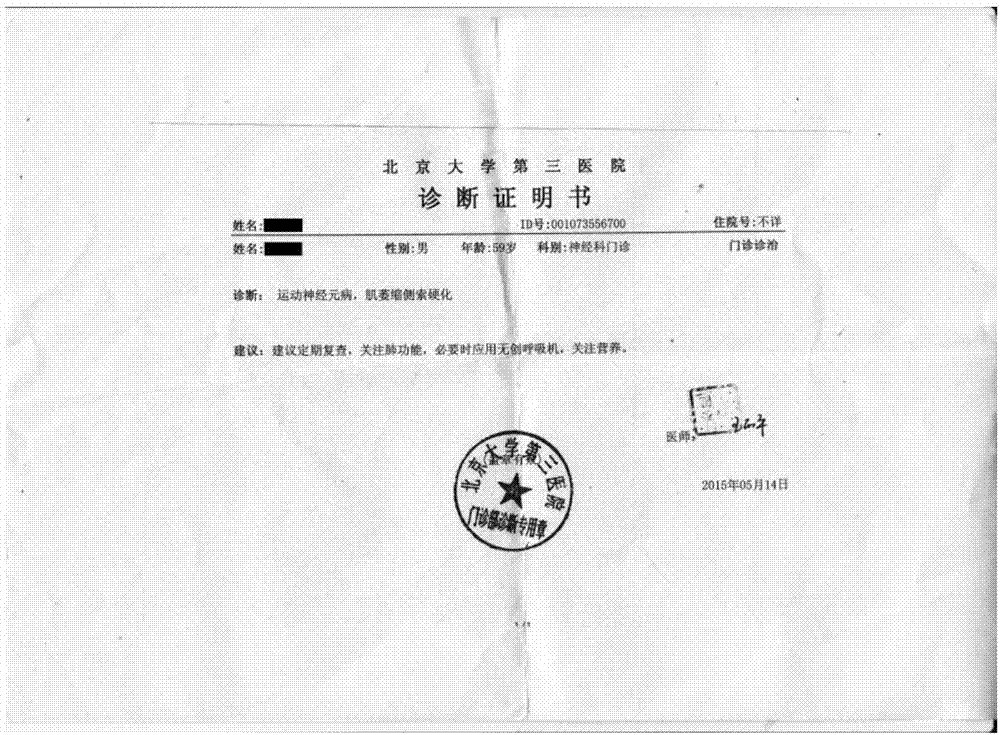一种用于治疗运动神经元病的组合物及其用途的制造方法与工艺