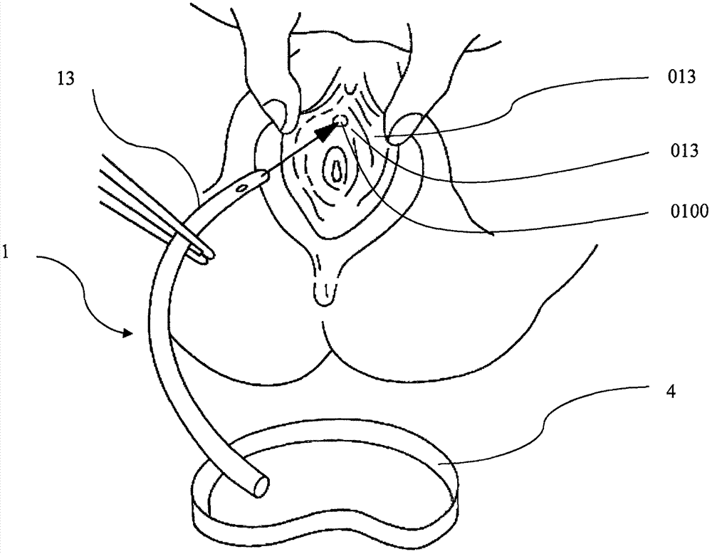 一种女性专用导尿管的制造方法与工艺