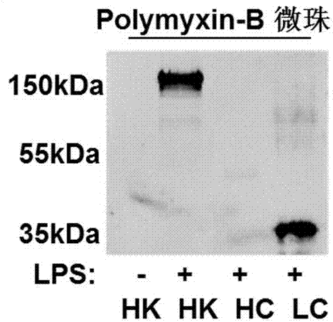 一种脂多糖结合蛋白多肽及其制药用途的制造方法与工艺