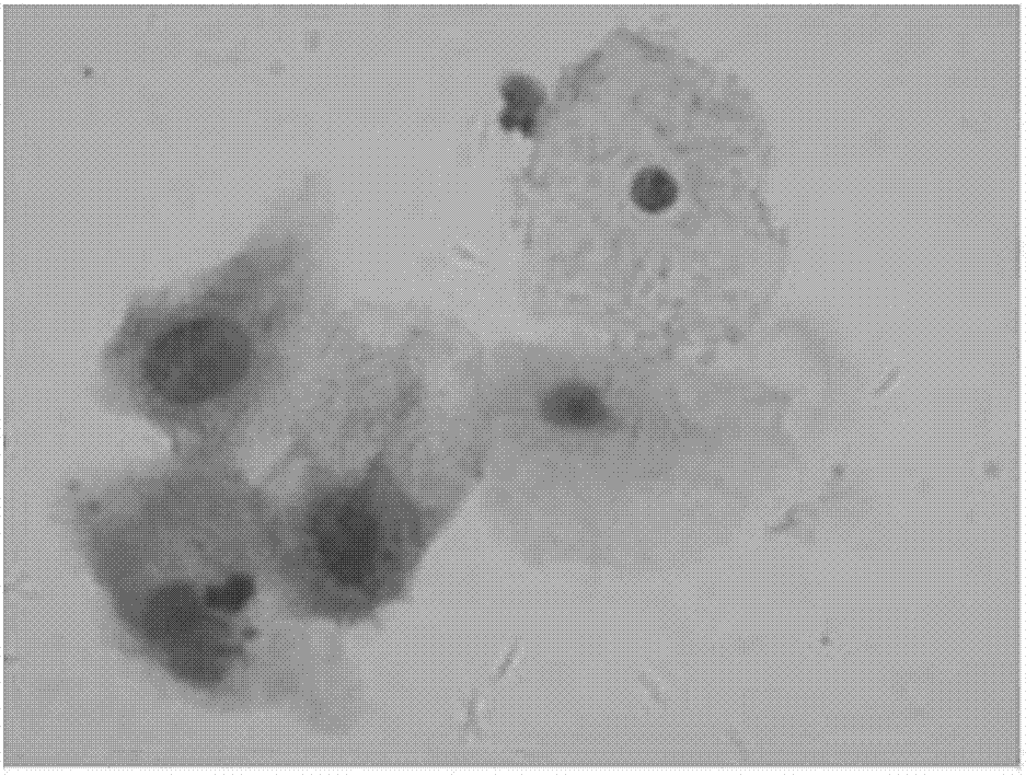 一種用于宮頸液基細(xì)胞的p16INK4a免疫標(biāo)記顯色試劑盒的制造方法與工藝