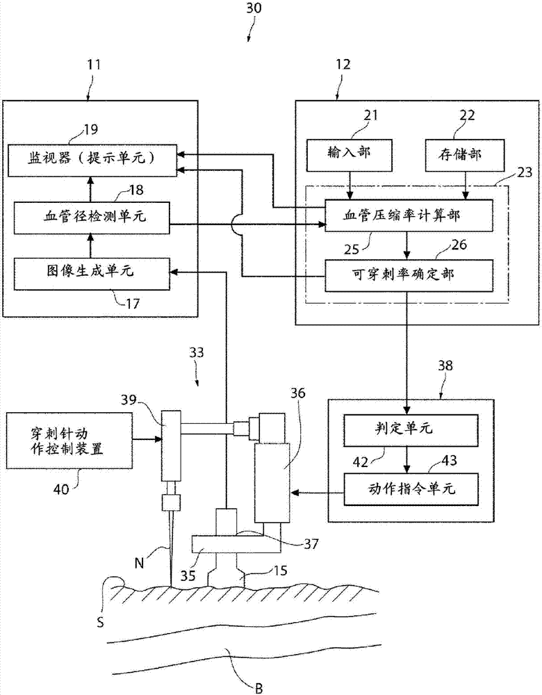 穿刺支援系統(tǒng)的制造方法與工藝