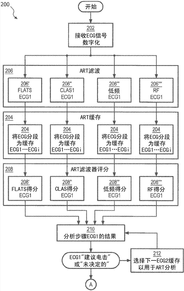 利用雙ECG分析算法的自動(dòng)體外除顫器(AED)的制造方法與工藝