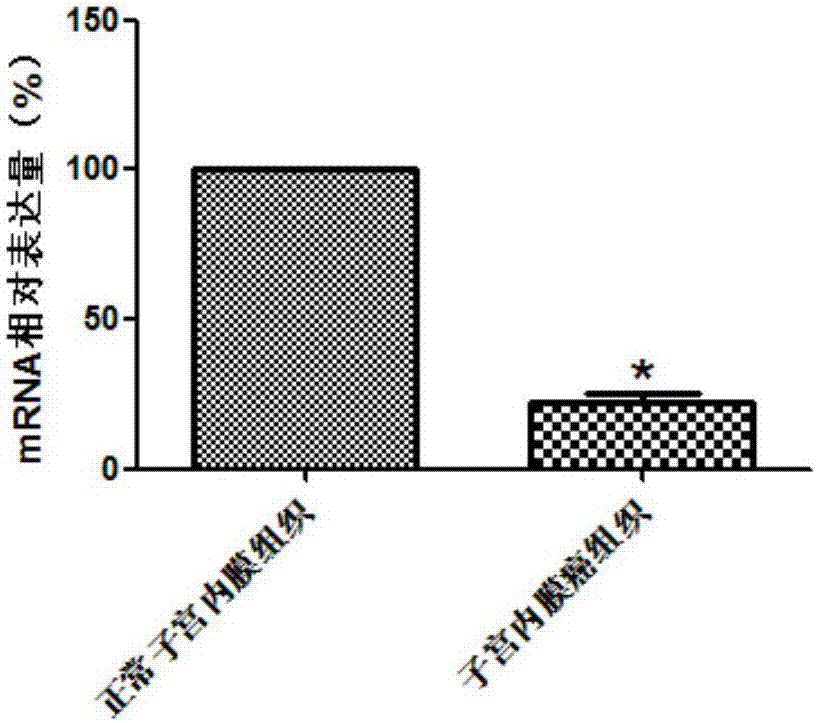 MYLK基因作为诊断子宫内膜癌的标志物的制造方法与工艺