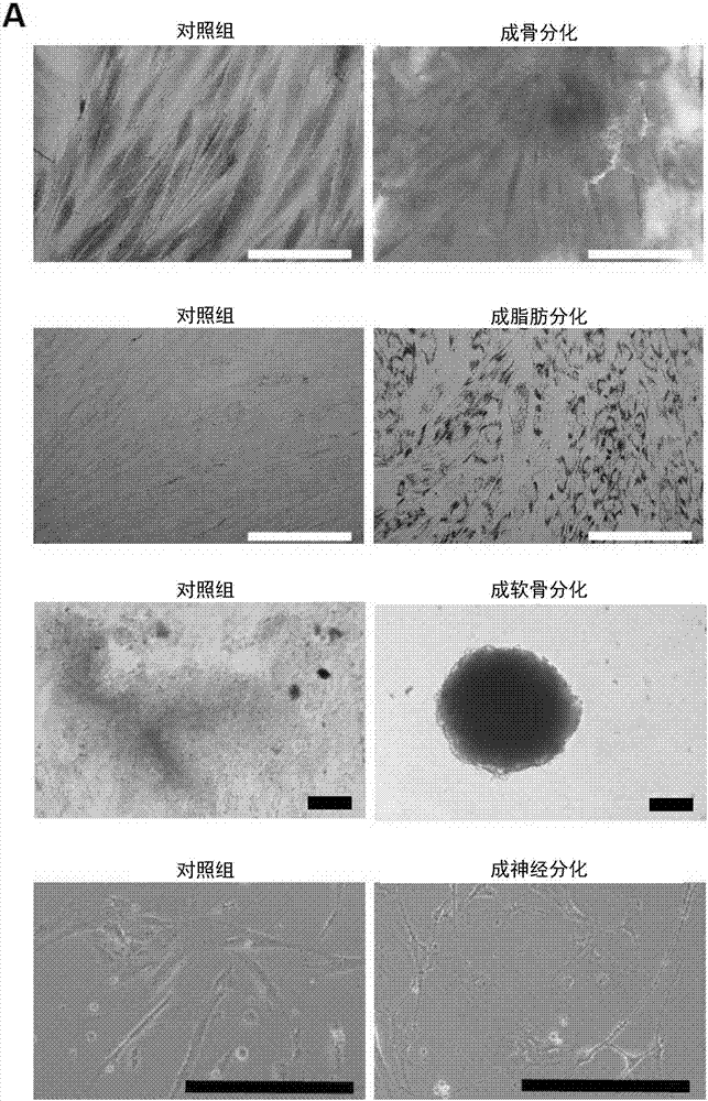 祖細(xì)胞、其制備方法及其應(yīng)用與流程