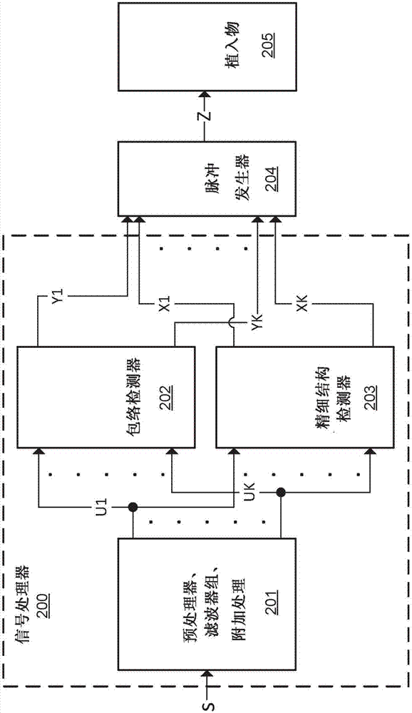 具有牺牲件的镫骨肌反射记录电极的制造方法与工艺