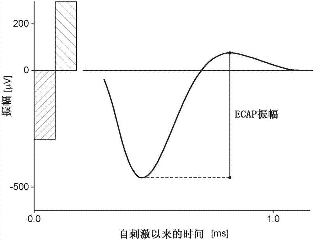 经由传出神经纤维的耳蜗植入器适配的制造方法与工艺