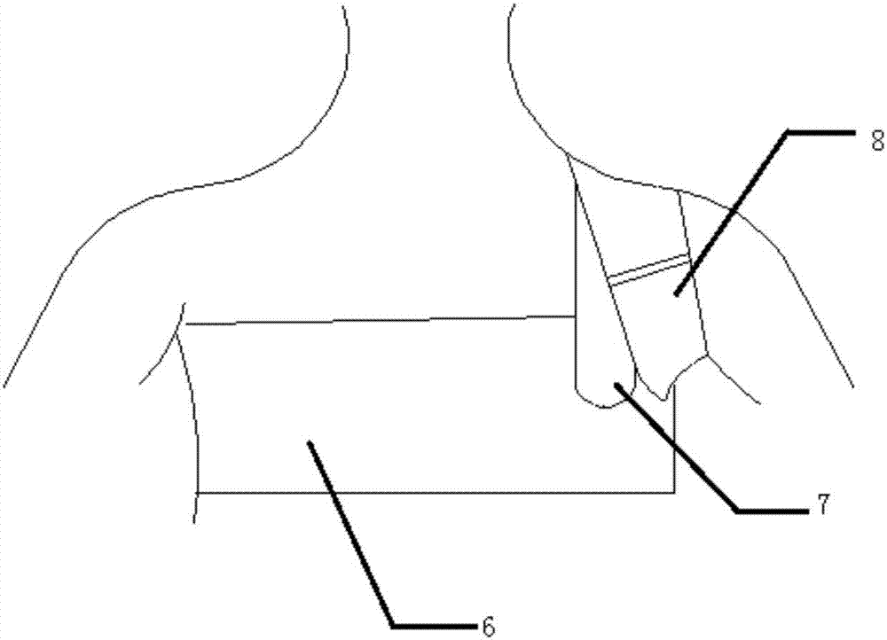 一种单侧腋下加压绷带的制造方法与工艺