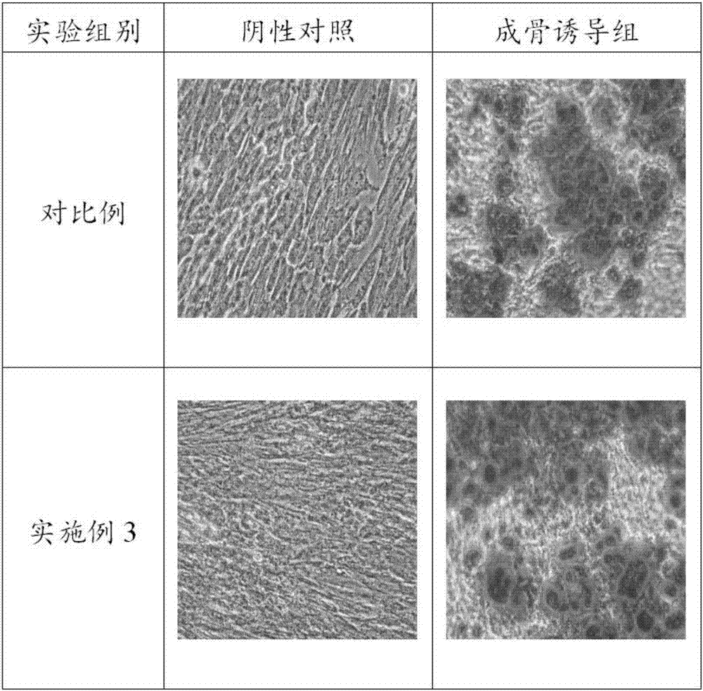 一种牙周膜干细胞的冻存液及其冻存方法与流程