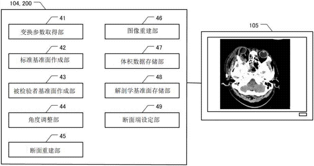 医用断面显示装置和断面图像显示方法与流程