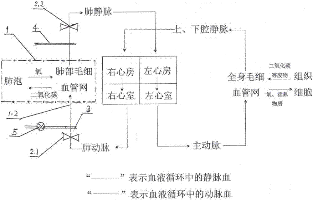 脏器自体体内修复用手术器械包的制造方法与工艺