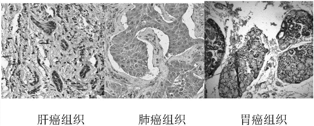 一种靶向人肿瘤干细胞的单克隆抗体及其应用的制造方法与工艺