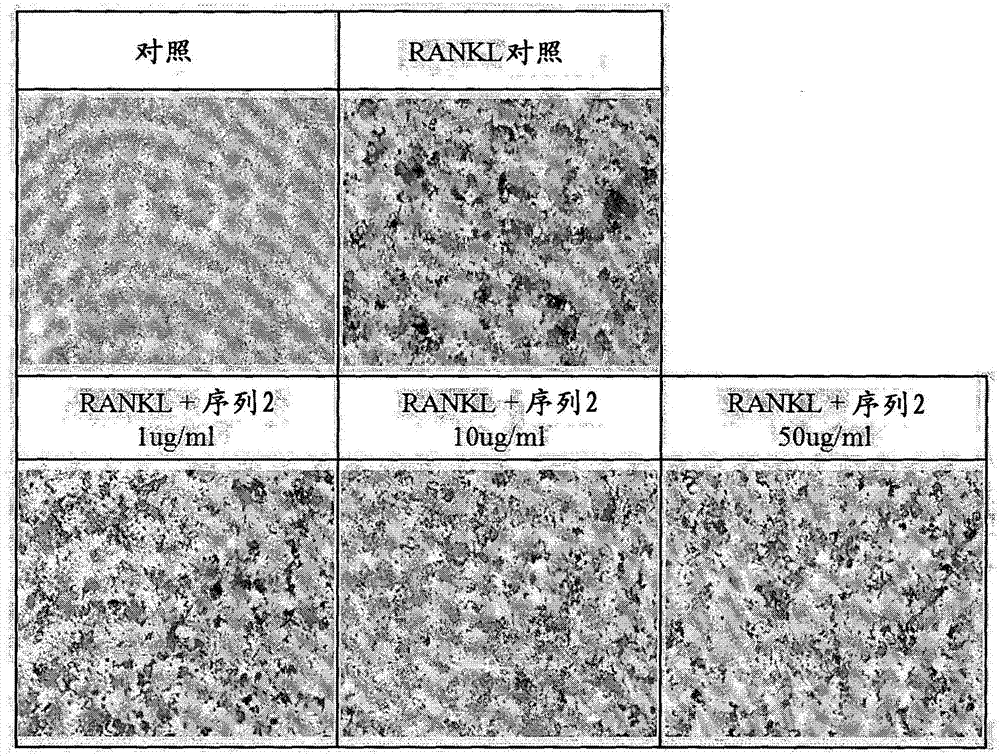 具有破骨细胞分化及活性抑制能力的肽及其用途的制造方法与工艺