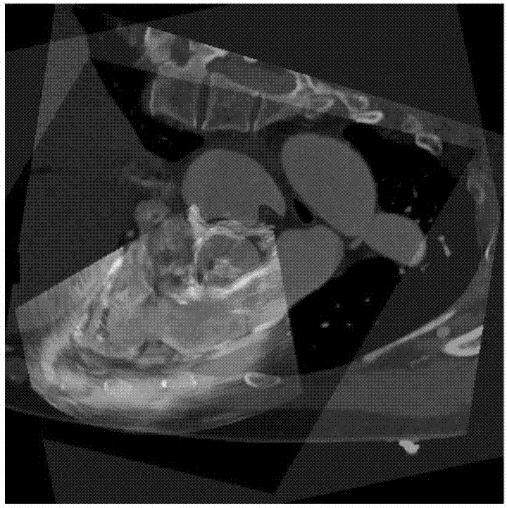 基于瓣膜对齐及概率图的心脏CT‑TEE配准方法与流程
