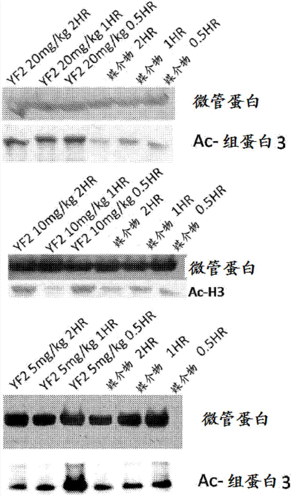 組蛋白乙酰轉(zhuǎn)移酶激活劑的用途的制造方法與工藝