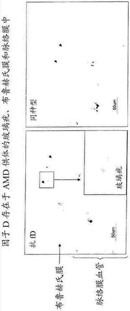补体相关眼疾的预防和治疗的制造方法与工艺