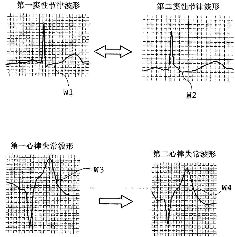 心脏导管检查装置、心脏导管检查系统以及心脏导管检查方法与流程