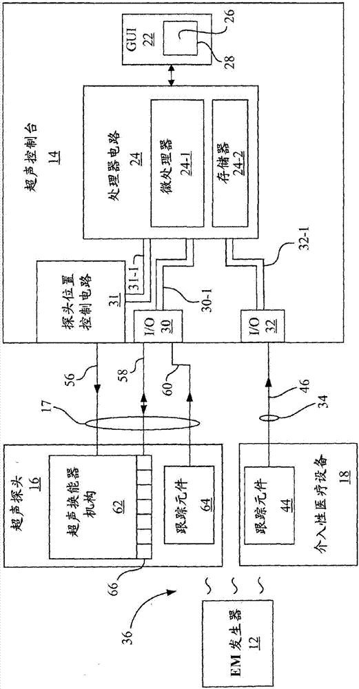 具有自动图像呈现的超声成像系统的制造方法与工艺