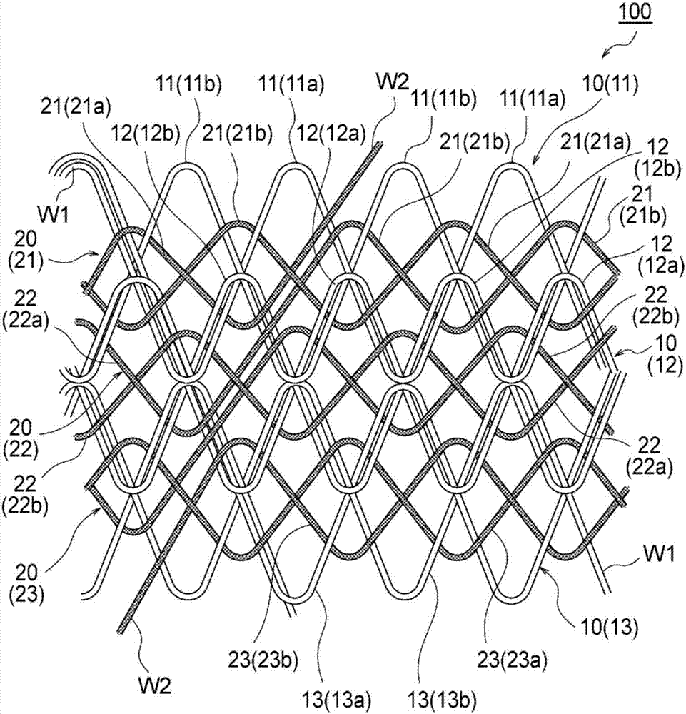 支架以及覆膜支架的制造方法與工藝