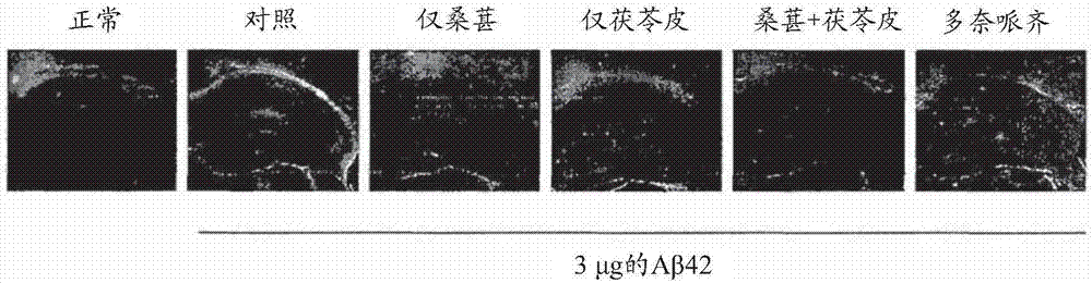 预防、改善或治疗退行性神经系统疾病的含桑葚和茯苓皮的混合提取物的组合物的制造方法与工艺