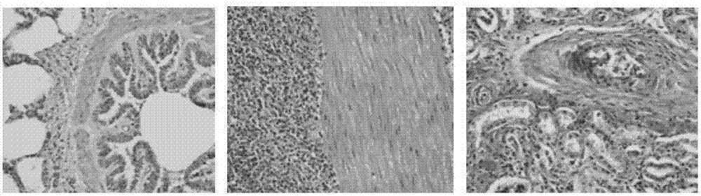 一种组织病理图像分类方法与流程