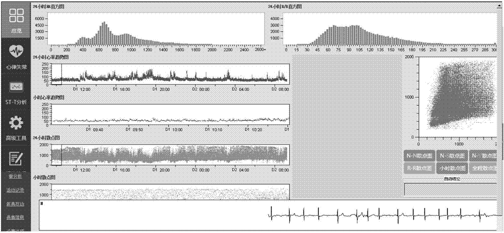心電數(shù)據(jù)分析工具系統(tǒng)及使用方法與流程