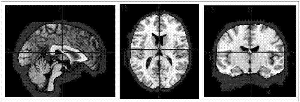 基于成组SIM算法的大脑功能磁共振成像盲源分离方法与流程