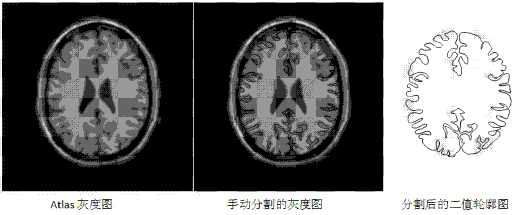 一種基于atlas的頭部MRI圖像分割方法與流程