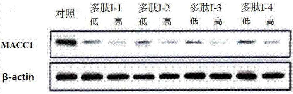 一種MACC1基因的抑制劑及其抗肝細胞癌侵襲用途的制造方法與工藝