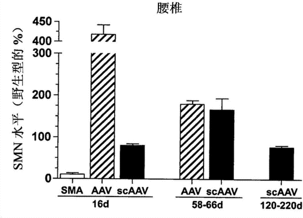 神經(jīng)退行性疾病的基因治療的制造方法與工藝